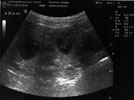 Ultraschallbild von Odettas Welpen